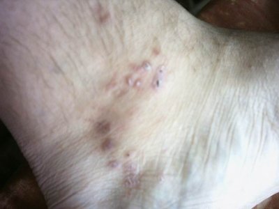 изменение размера ступня.jpg