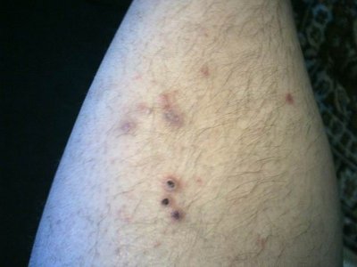 изменение размера голень.jpg