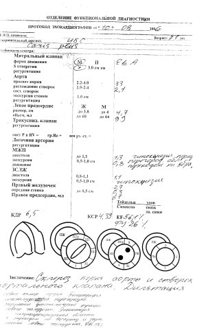 Эхокардиография.jpg
