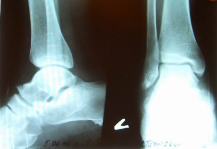 Изменение размера CIMG0005.jpg