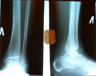 Изменение размера CIMG0006.jpg