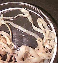 ленточный червь цестод (цепень).jpg