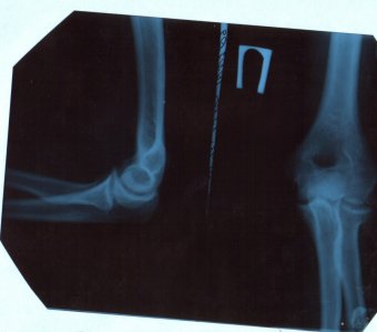 через 2 недели.jpg