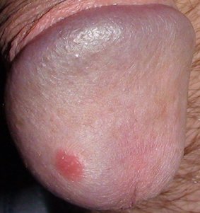 Красное пятно.jpg