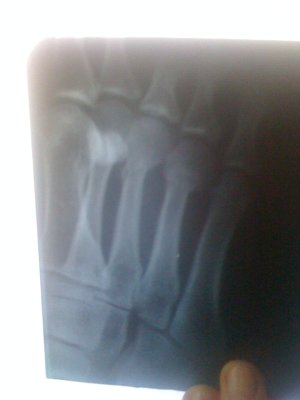 рентген 004_.jpg