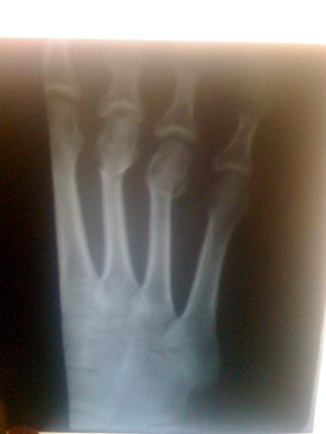 рентген 006_.jpg