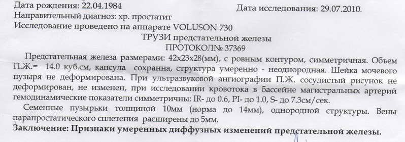 54323432.jpg 54323432.jpg