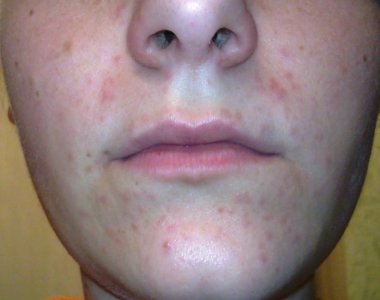 260120113151111.JPG 260120113151111.JPG