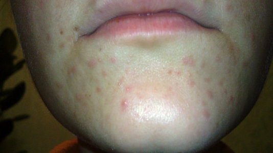 26012011317.JPG 26012011317.JPG