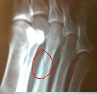 x-ray1.JPG