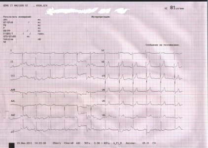 Копия Изображе
.jpg