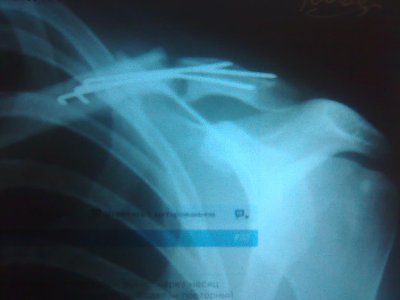 Зображення126.jpg Зображення126.jpg