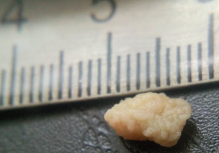 HplAjfo0.jpg HplAjfo0.jpg