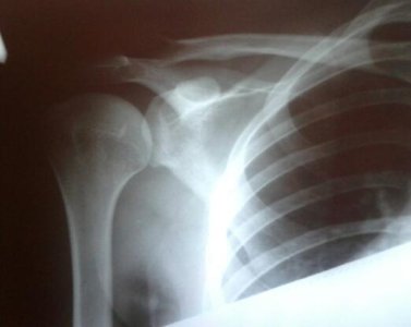 2012-06-10 22.54.52-1.jpg