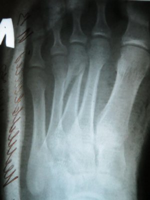 IMG_134 6.jpg IMG_134 6.jpg