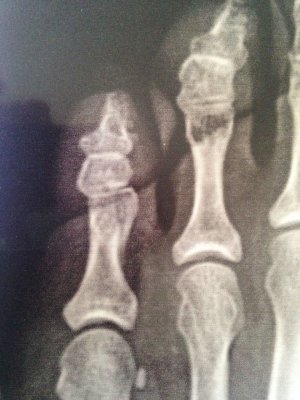 IMG-20170119-WA0003.jpg IMG-20170119-WA0003.jpg