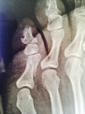 IMG-20170119-WA0002.jpg IMG-20170119-WA0002.jpg