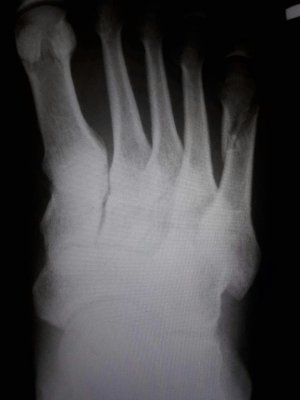 20170701_231724.jpg