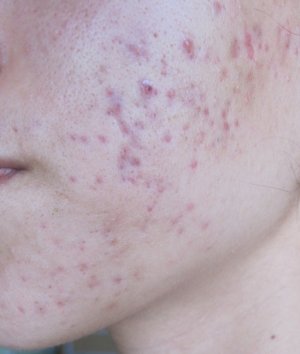 IMG_8161.JPG IMG_8161.JPG