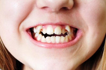 distopija-zubov-u-dete-01j.jpg distopija-zubov-u-dete-01j.jpg