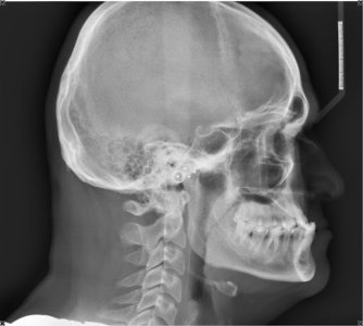 Цефалометрический снимок.jpg